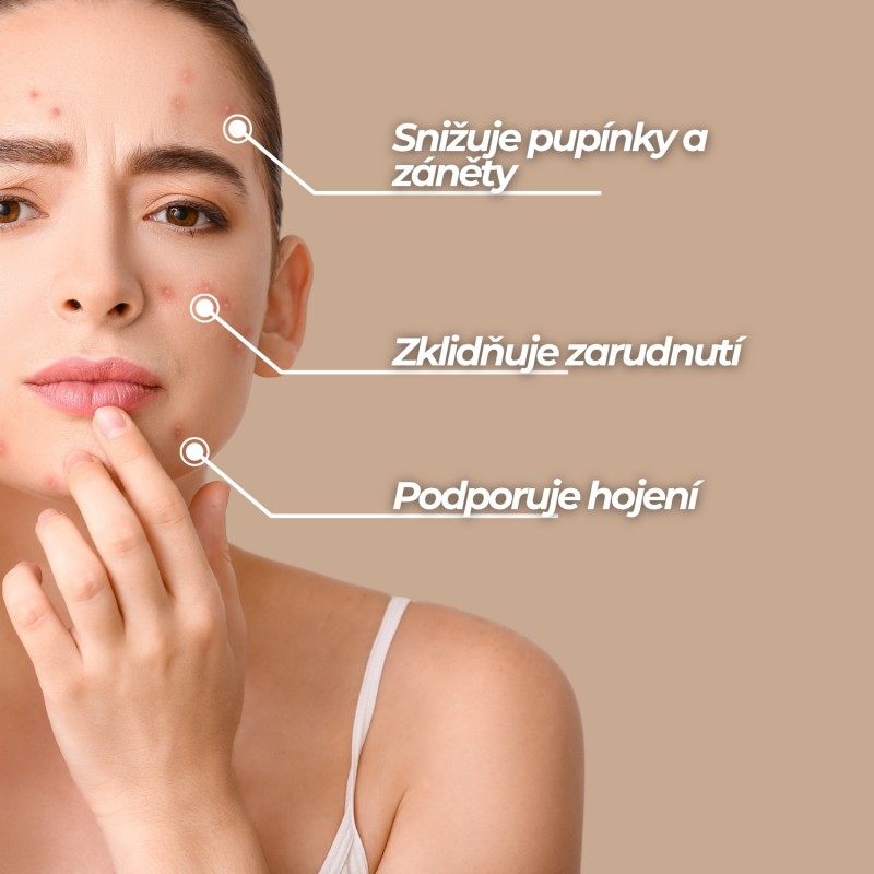 Krém na Obličej Proti Akné - 50ml