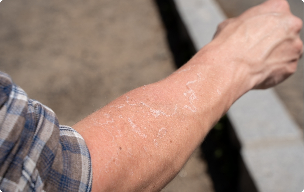 Jako olej pro podrážděnou a suchou pokožku