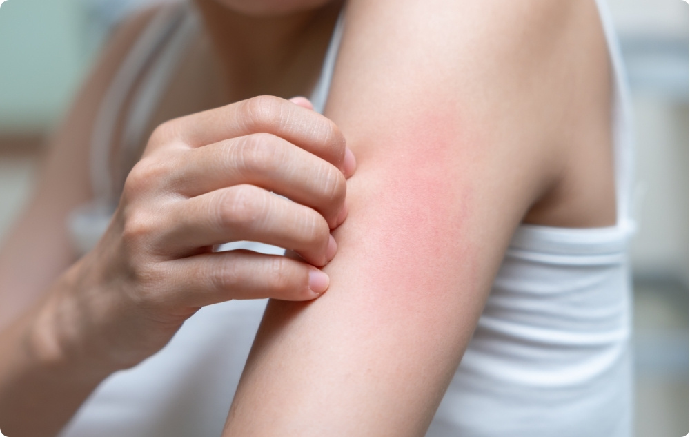 Jako zklidňující olej pro citlivou nebo podrážděnou pokožku