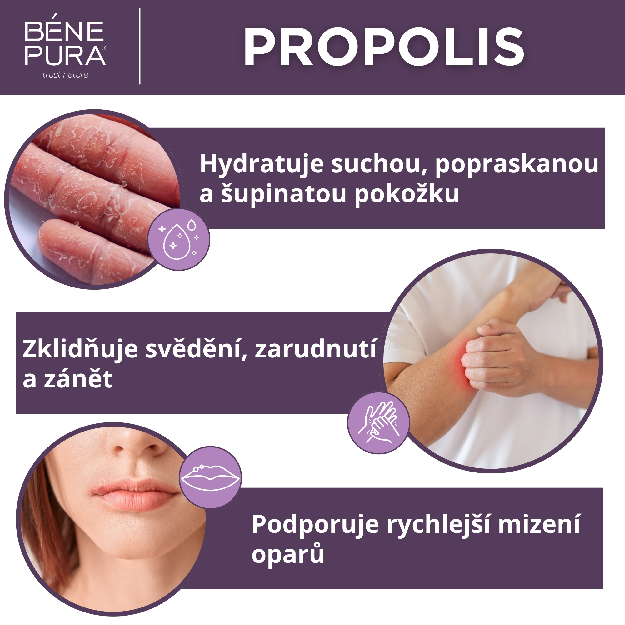 Sada "Masti na Svědění"