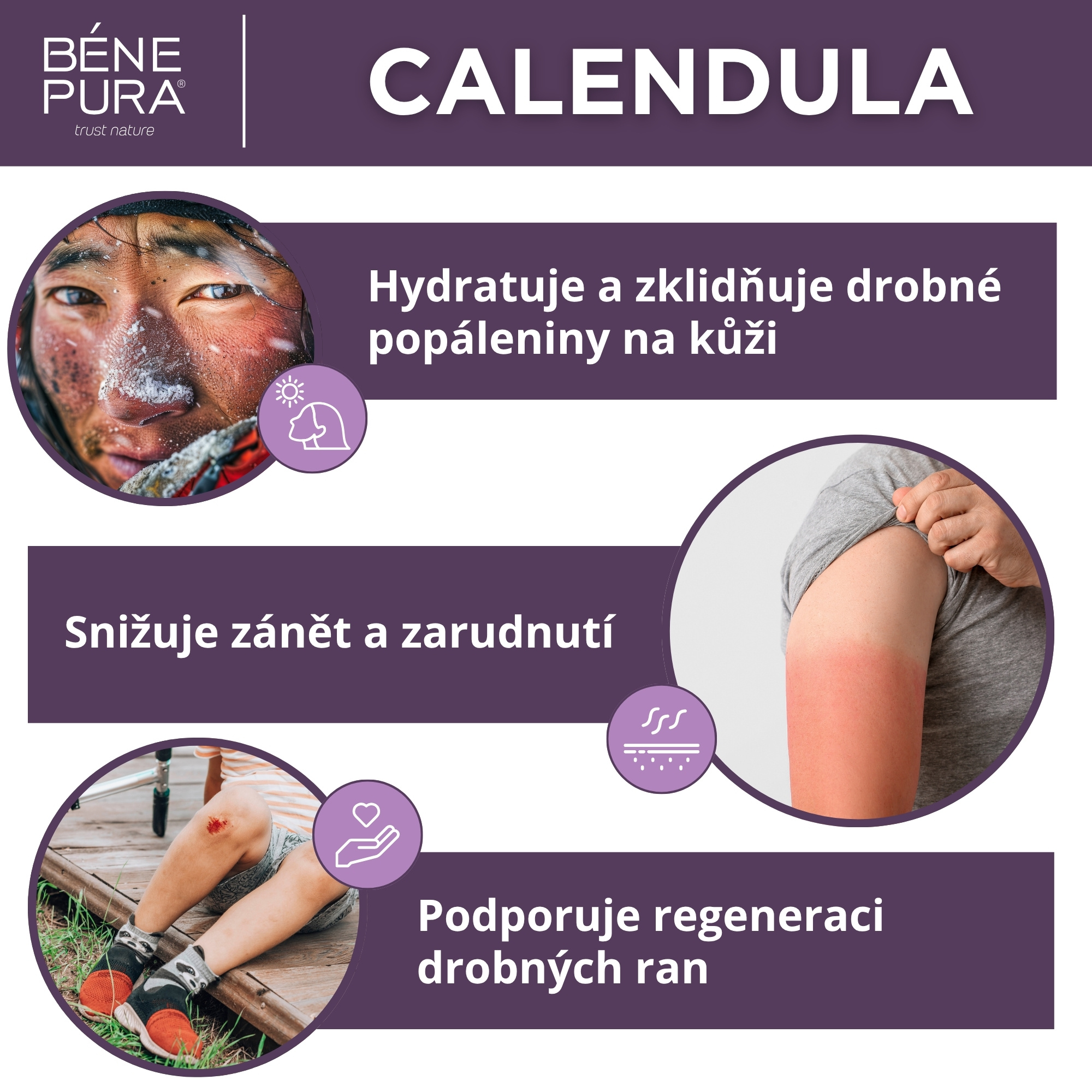 Mast na Popáleniny a Rány s Měsíček lékařský, Aloe Vera a Třezalka tečkovana - 40ml